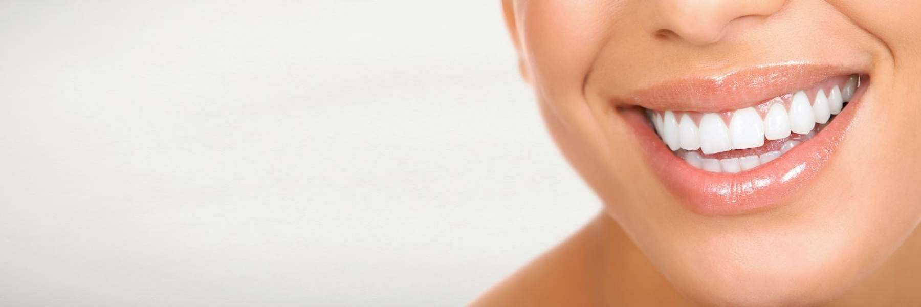 After Cosmetic Dentistry Her Smile