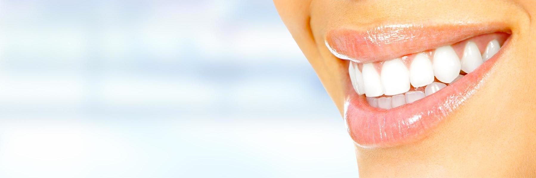woman with teeth whitening in aurora co