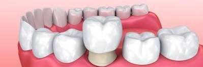 aurora co dentist