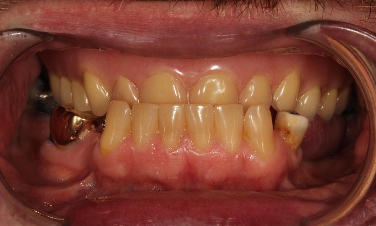 Smile Makeovers in Aurora | Dr. John Chen