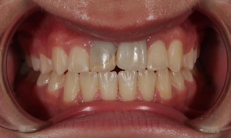 dentist in aurora co