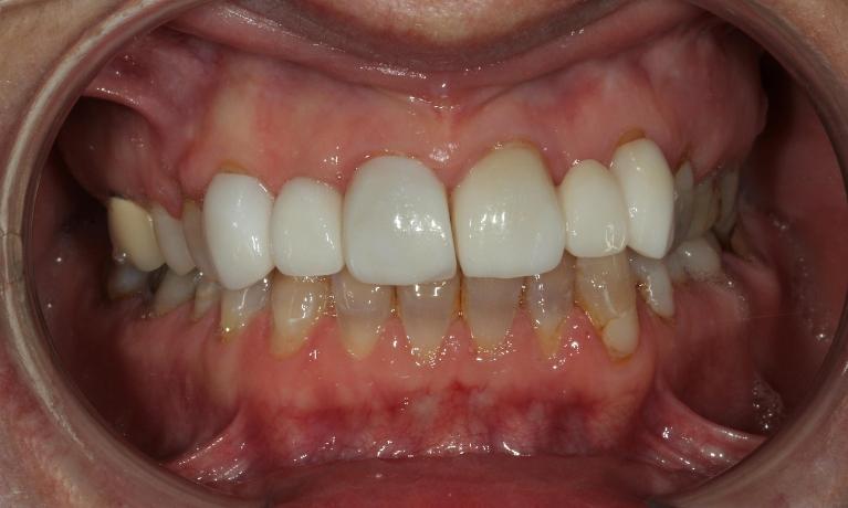 dentist in aurora co